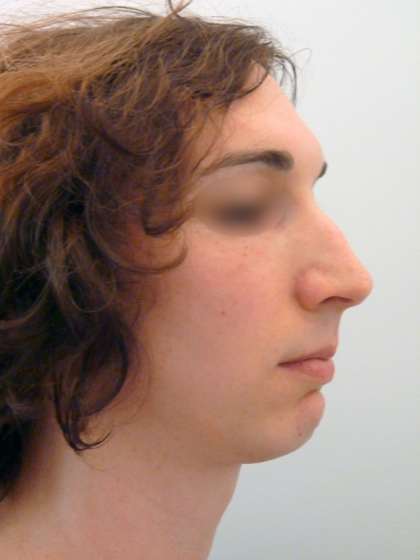 Généralités & féminisation du visage